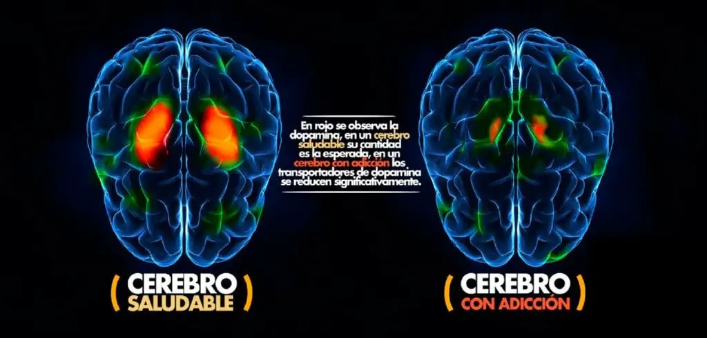 Explicacion detallada de que le sucede al cerebro. Fuente bloghelenkeller.com.mx