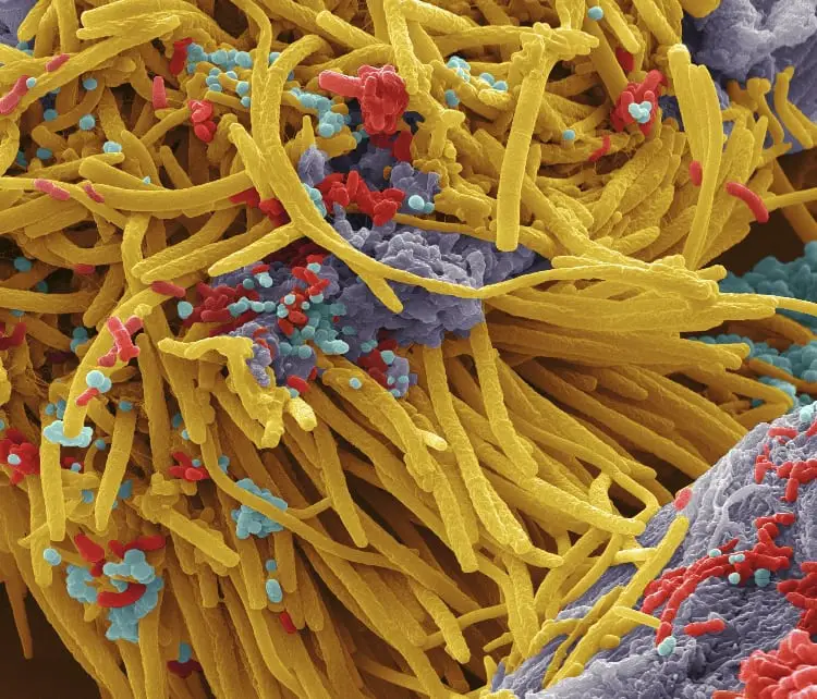 bacterias toma microscopica