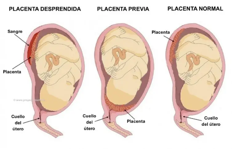 Las 3 Funciones De La Placenta Durante El Embarazo Como Funciona Que