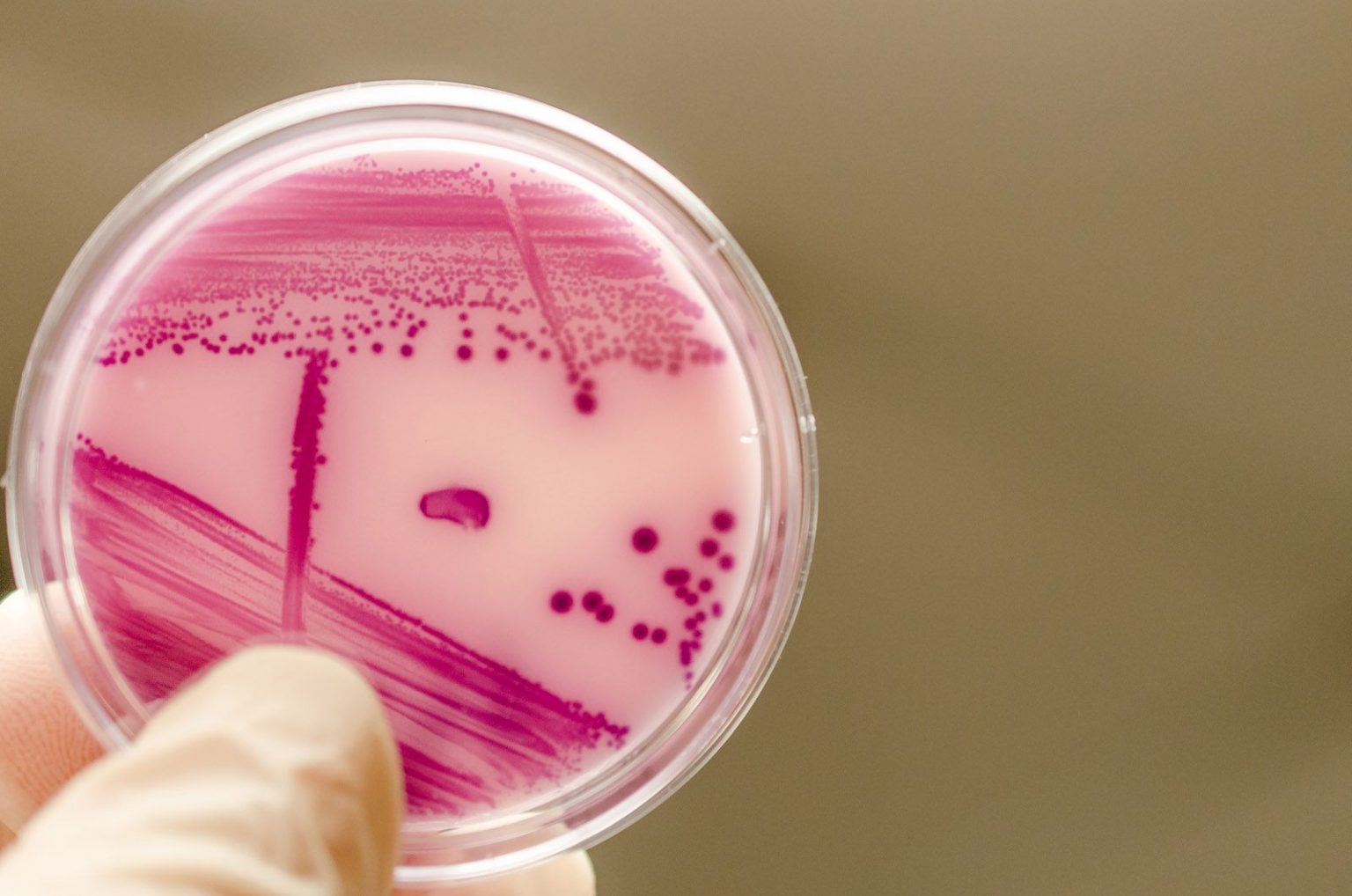 Escherichia Coli La Bacteria Que Vive En El Intestino Como Funciona Que