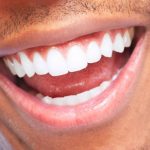 ¿Cómo blanquear los dientes?: 10 consejos de expertos