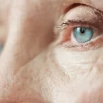 glaucoma