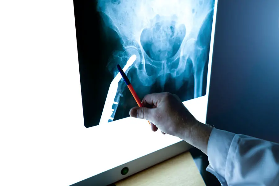 radiologia-cadera